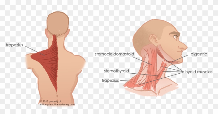Torso Muscles 7 - Sternomastoid Trapezius And Paravertebral Muscles Clipart