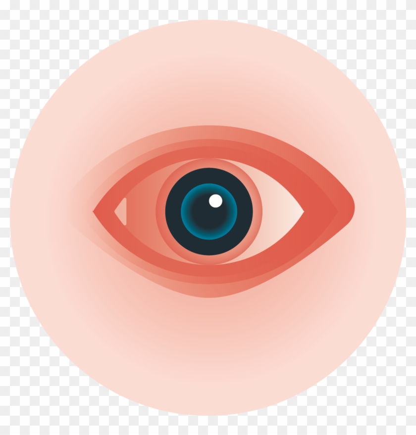 Png Royalty Free Library Collection Of Itchy Eyes High - Itchy Eye Icon Png Clipart