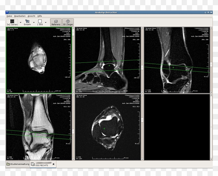 1346743 Alienarena 15 Sep 2016 - Dicom Format Clipart