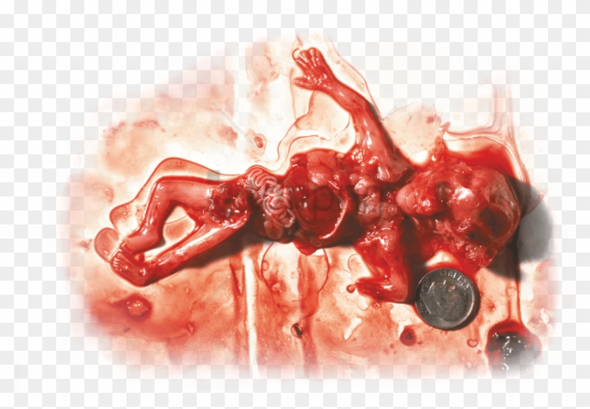 Free Png Download Not Your Body Abortion Meme Png Images - Marie Stopes Abortion Kenya Clipart