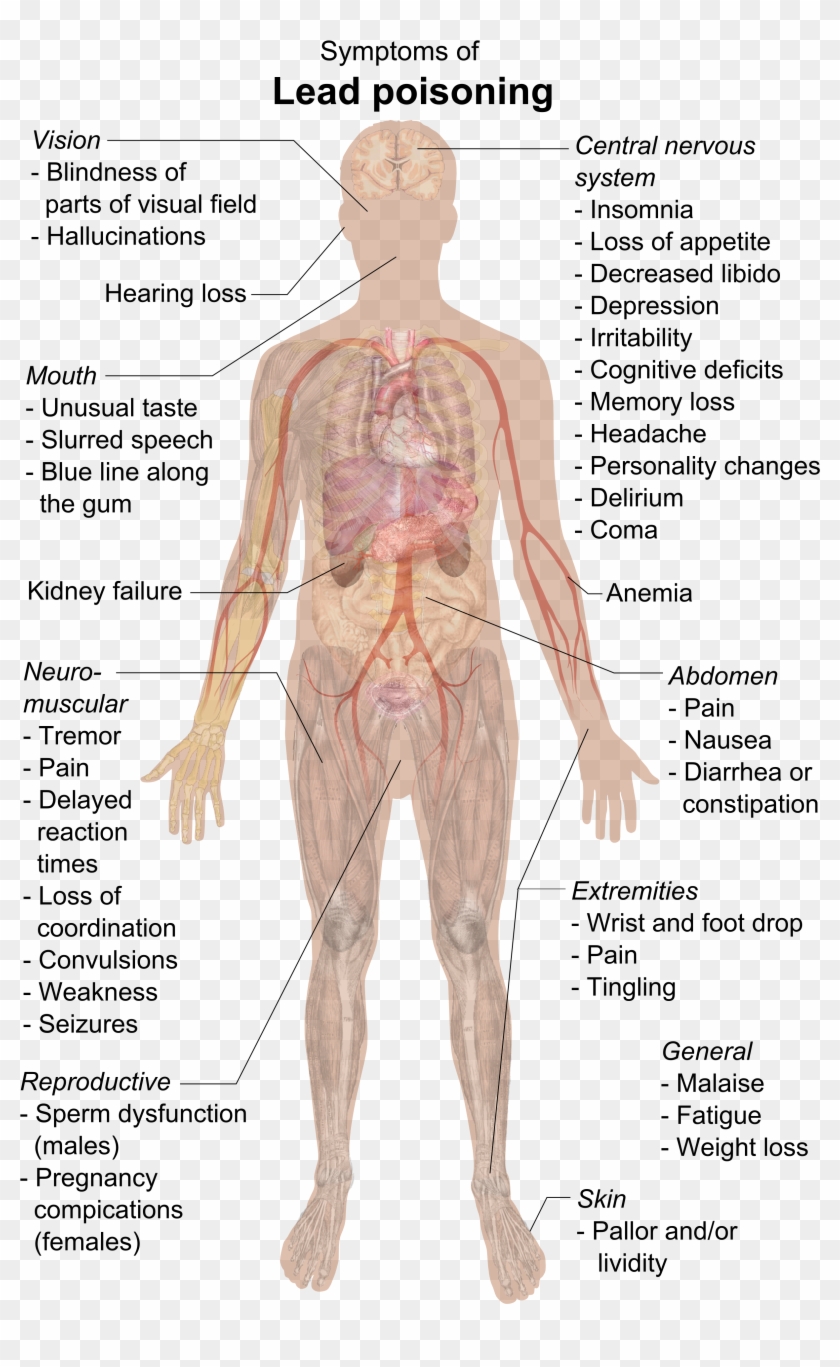 Symptoms Of Lead Poisoning - Lead Poisoning Symptoms Clipart #1856159