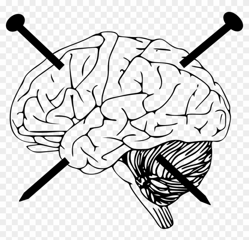 Physical Brain Damage And Amnesia - Brain Pic Black And White Clipart #1857101