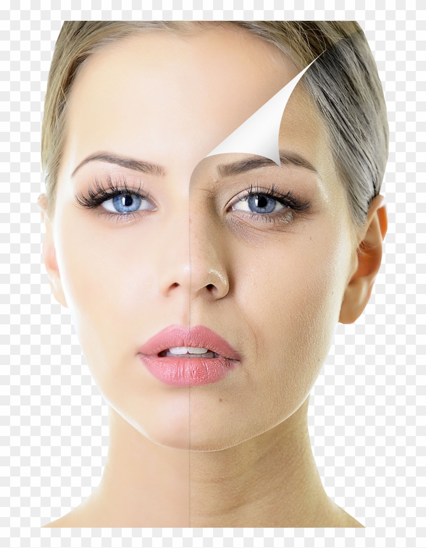 Beautiful Woman With Half Face Spotty Skin , Png Download Clipart
