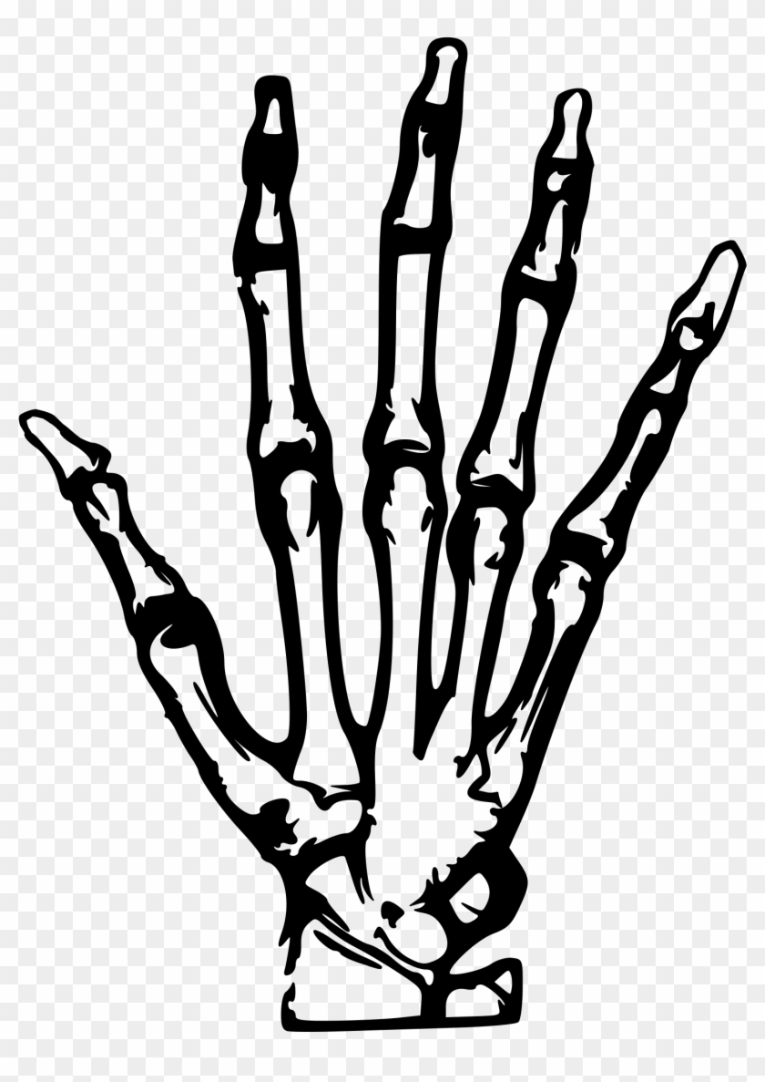 This Free Icons Png Design Of Hand X-ray - Skeleton Hand Tattoo Png Clipart
