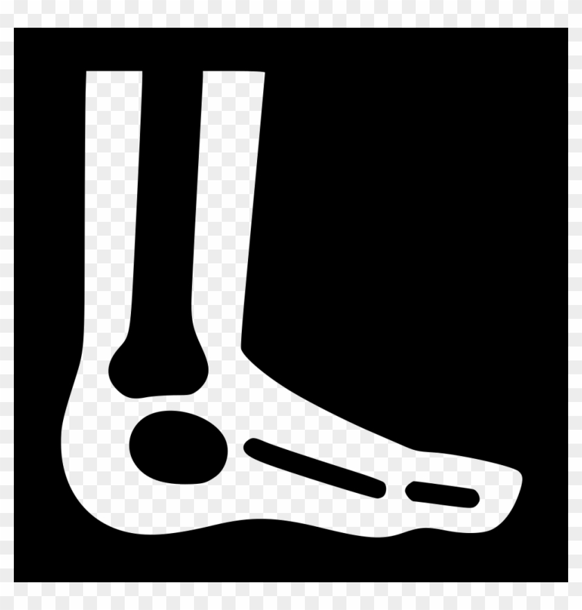 Png File Svg - Illustration Clipart #1875779