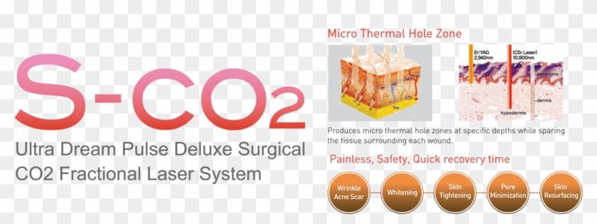 Laser > Vagina Laser > Sco2 Fractional Vaginal - Graphic Design Clipart #1936101