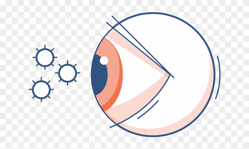 Illustration Of A Red Eye With Pollen Particles In Clipart #1958692