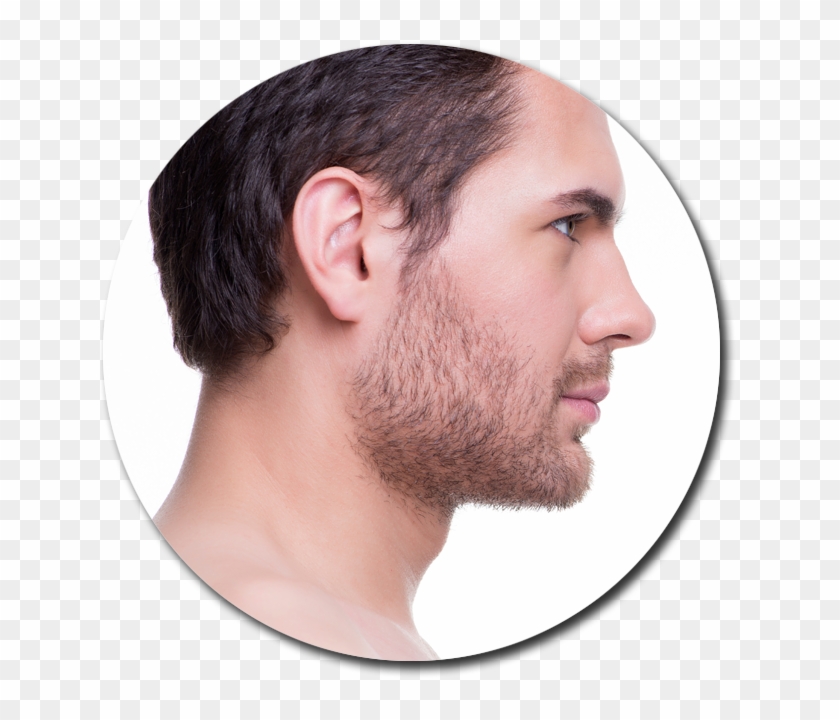 Double Chin Liposuction - Nariz Perfecta Para Hombre Clipart #2007105