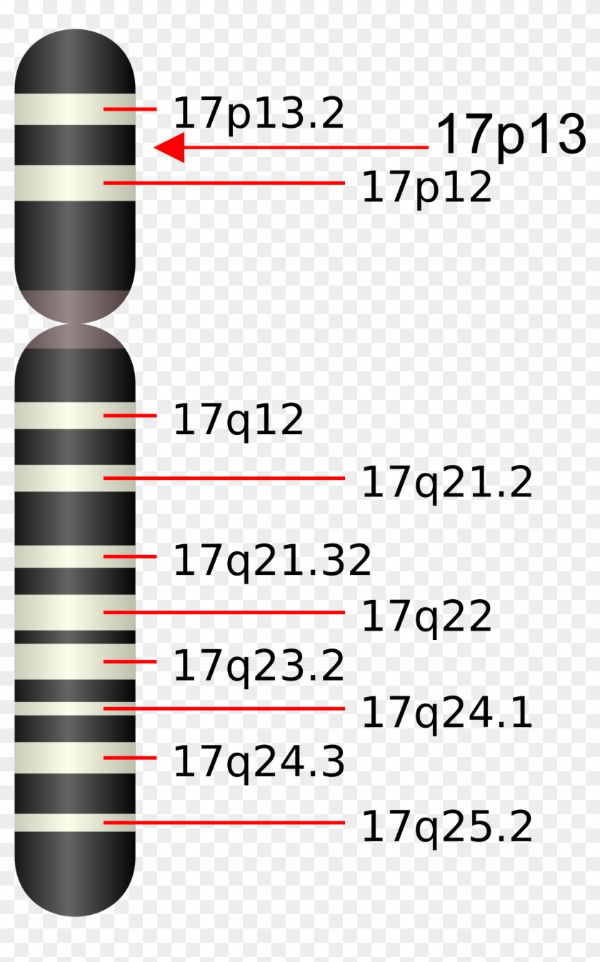 Ucsd Cystine Determination Laboratory - Smith Magenis Syndrome Gen Clipart