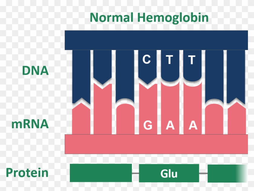 Point Mutation Sickle Cell Normal Hemoglobin , Png - Diagram Sickle Cell Mutations Clipart
