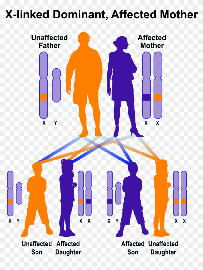 X-linked Dominant, Mother Affected - X Linked Dominant Clipart #2074859