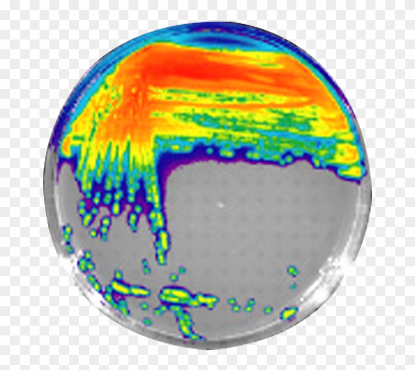 Aeruginosa Bioluminescent Bacteria - Pseudomonas Aeruginosa Uv Light Clipart
