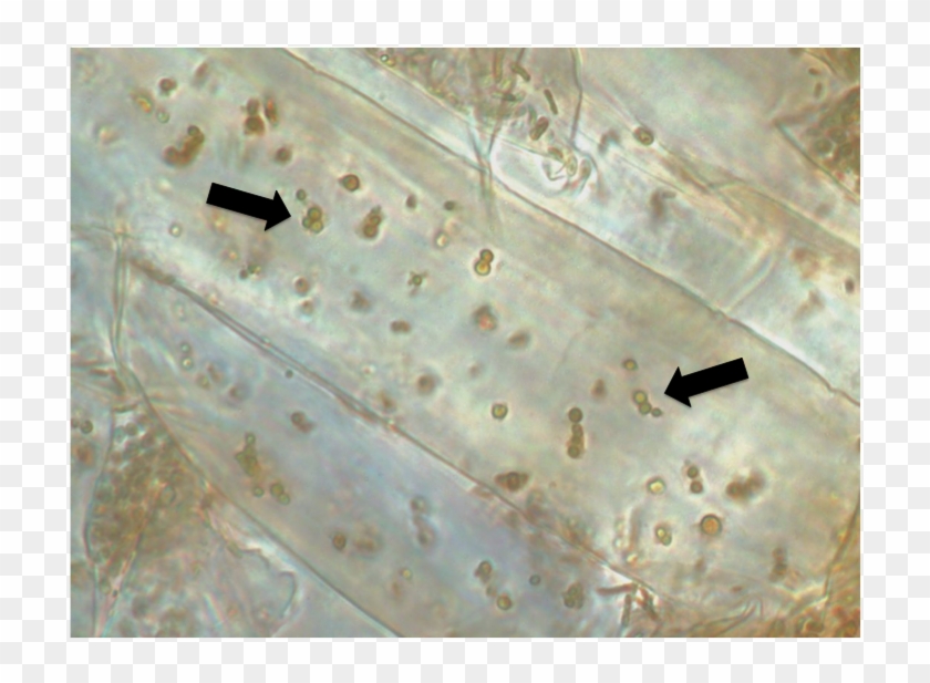 Root Cells Of Seedlings Of Phragmites Containing Endophytic - Seeds And Endophytic Bacteria Clipart