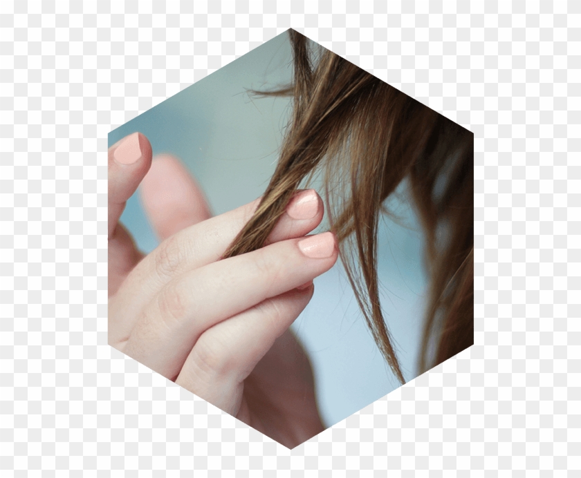 Woman With Hair Loss Touching Hair - Girl Clipart
