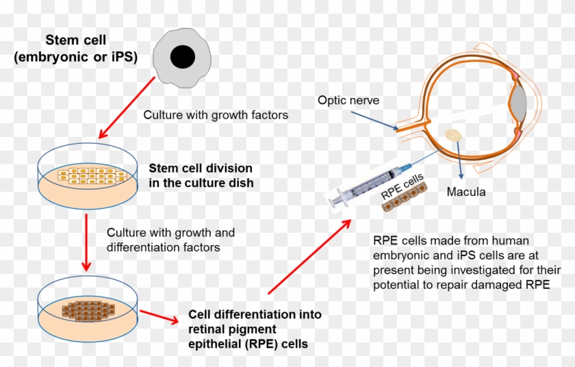 Diagram On Developing Eye Therapies - Stem Cells In Eye Clipart