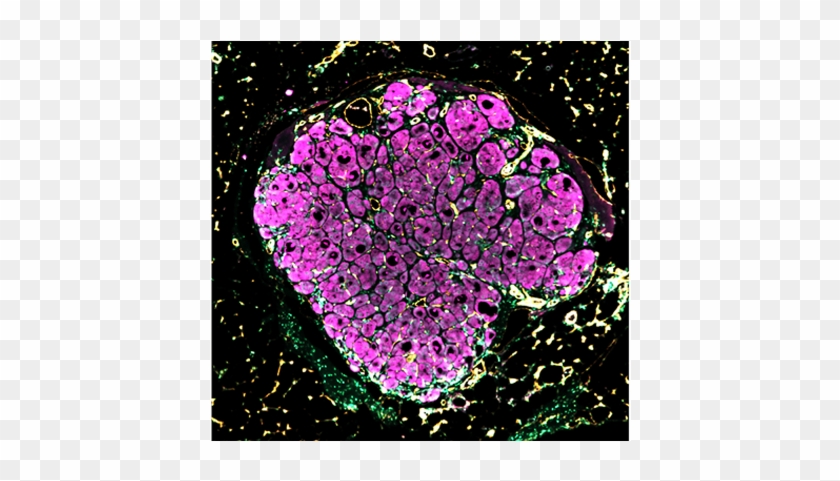 Engineered Human Liver Tissue “seeds” Blossom After - Liver Clipart