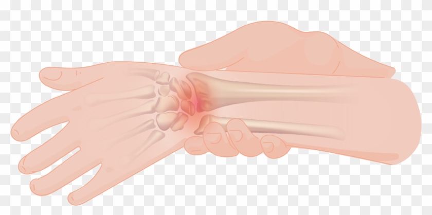 Wrist Pain - Glove Clipart