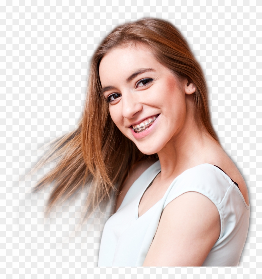 Braces Smile , Png Download Clipart #2204173