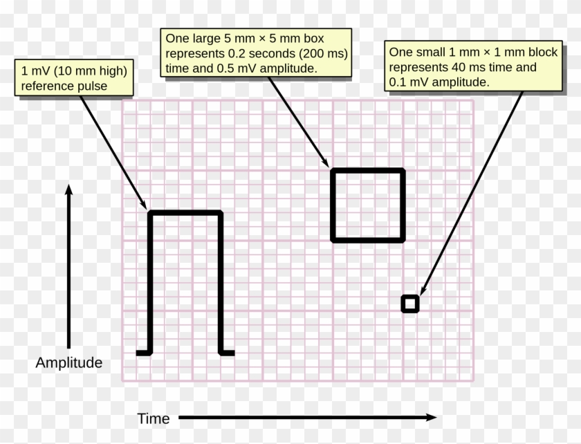 Clip Art Transparent Download Ekg Vector Vital Sign - Ecg Paper Speed - Png Download