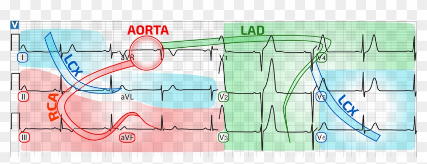 Vector Library Library Ecg Distribution - Blood Supply Heart Ecg Clipart