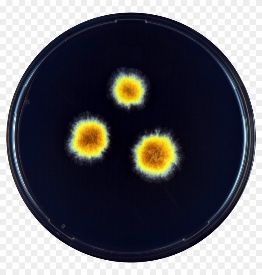 Aspergillus Megasporus Yes - Circle Clipart