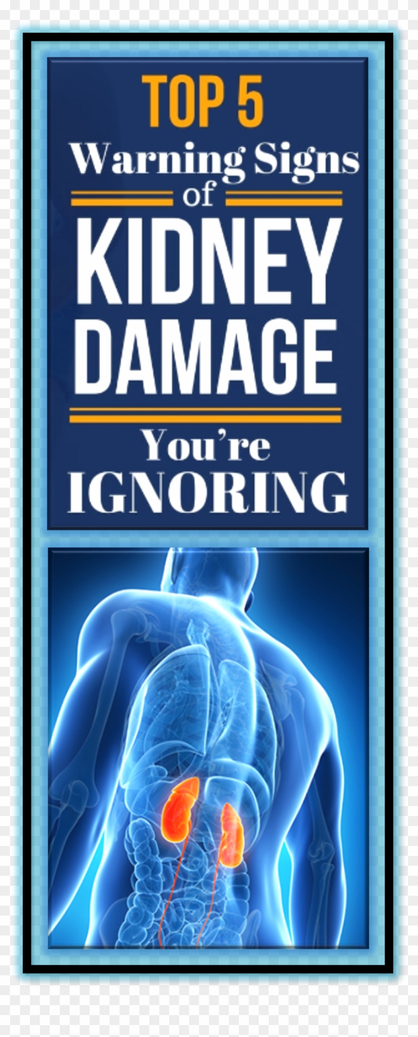 A Kidney Is A Reddish Brown, Bean-shaped Organ That - Poster Clipart