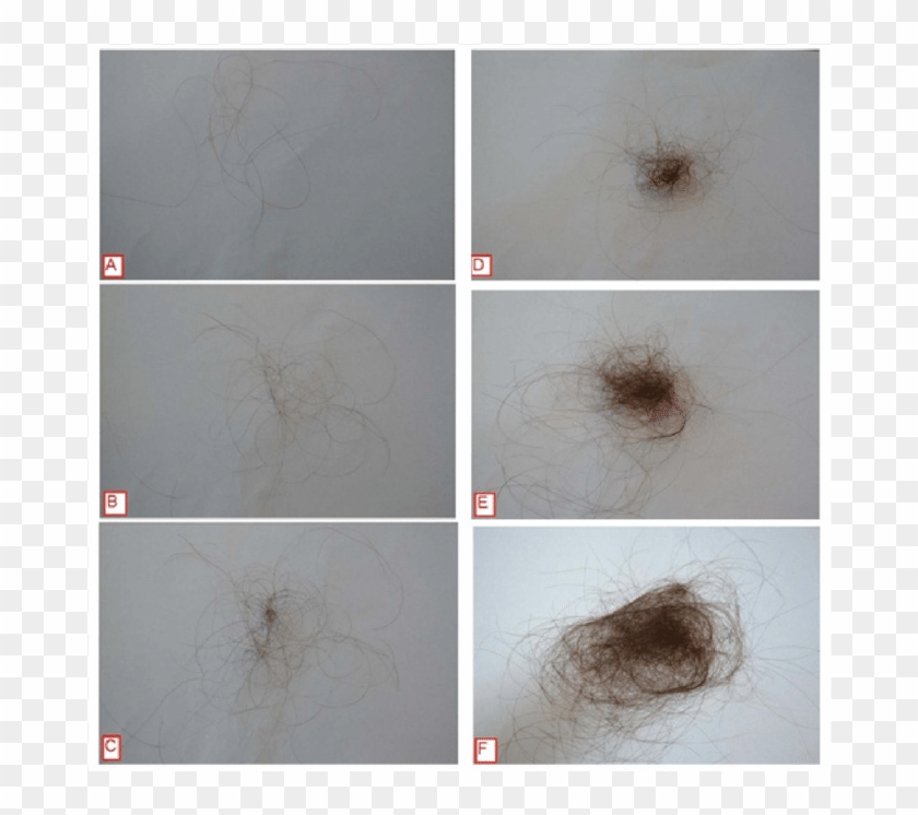 Hair Shedding Scale - Dandelion Clipart #2292951