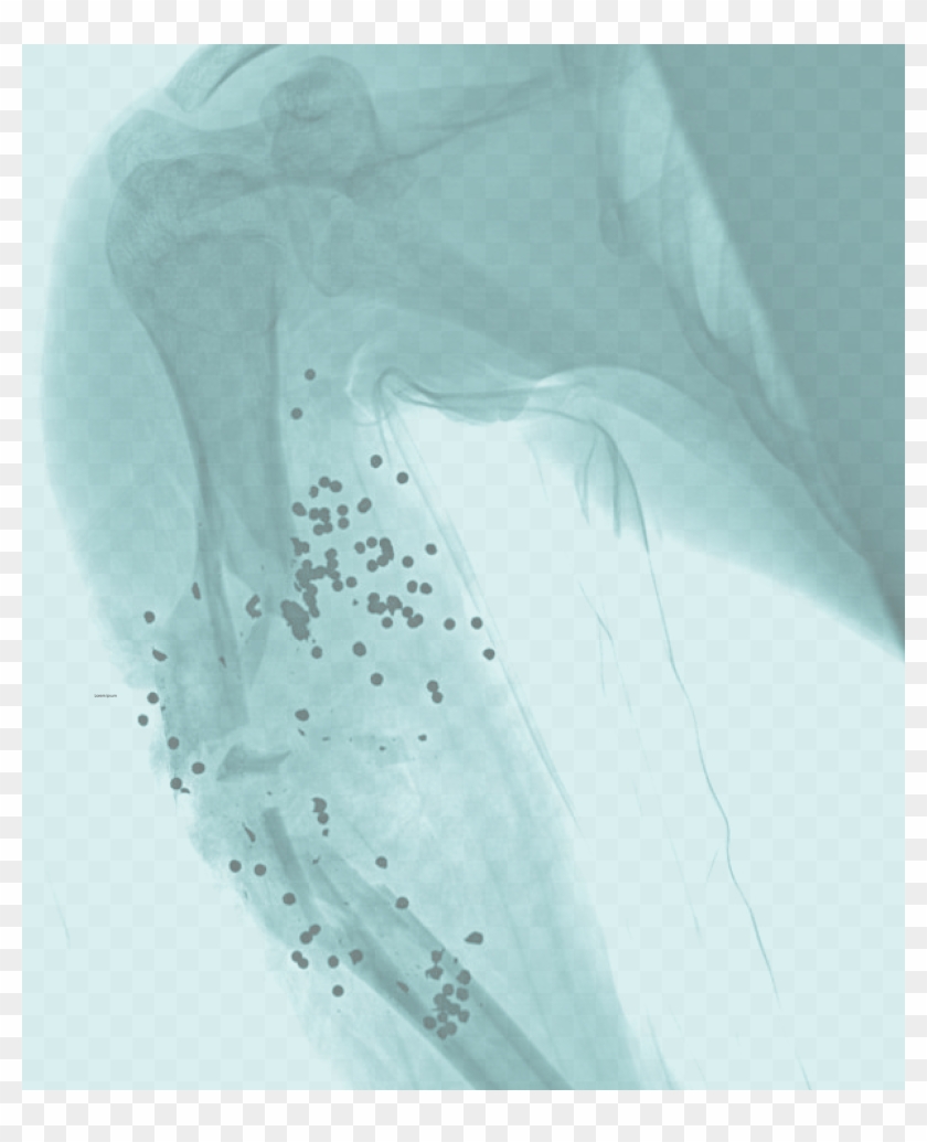 An X-ray Of A Shotgun Wound To The Upper Arm - Drawing Clipart #2348638
