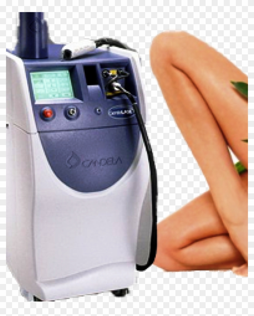 Candela Alexandrite Laser Epilation - Alexandrite Laser Clipart #2366158