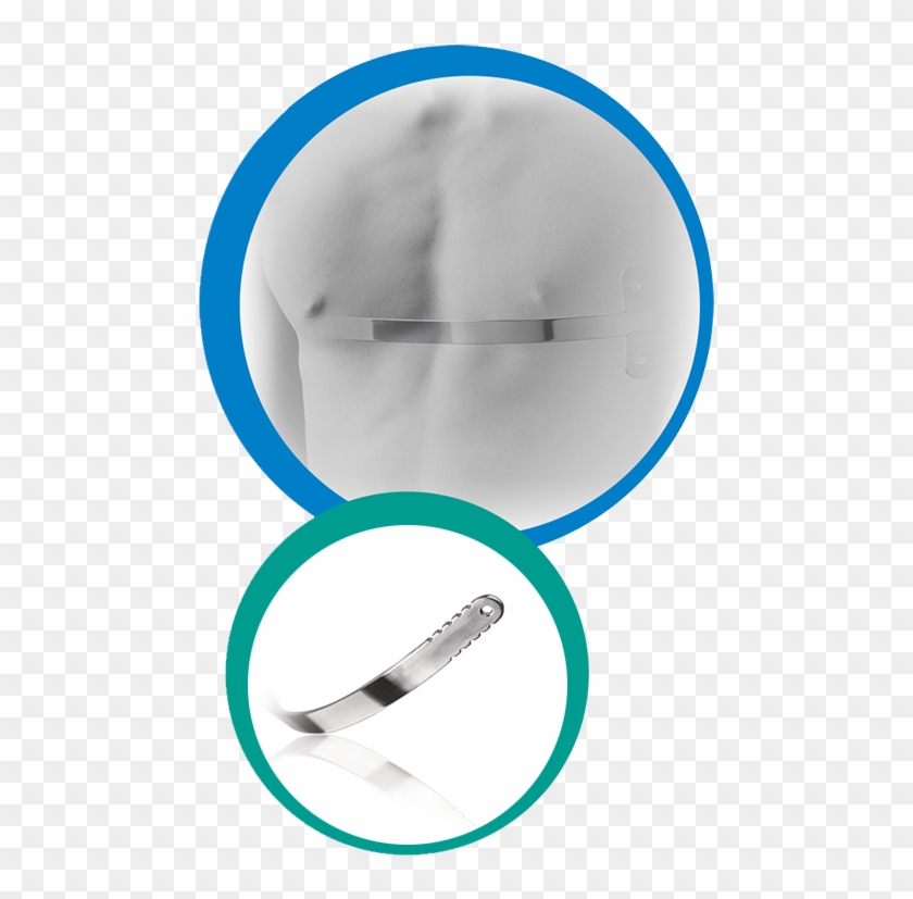 Circle Clipart #2450574