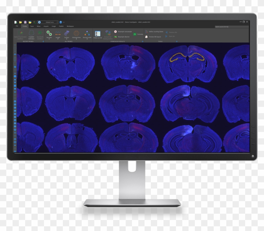 Stereo Investigator Whole Slide Edition Is A Tool For - Computer Monitor Clipart #2482312