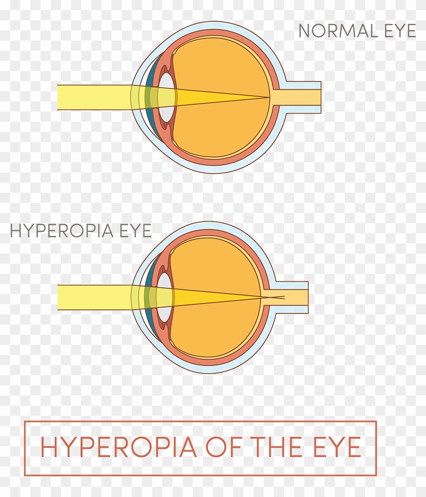 Illustration Of Human Eye - Circle Clipart