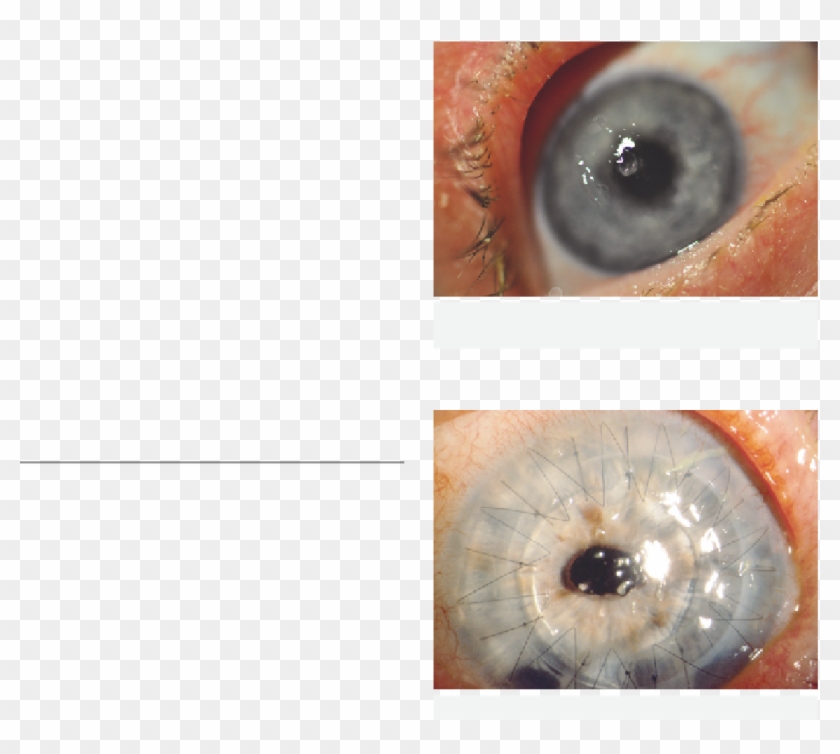 Ocular Surface Disease - Close-up Clipart #2534894