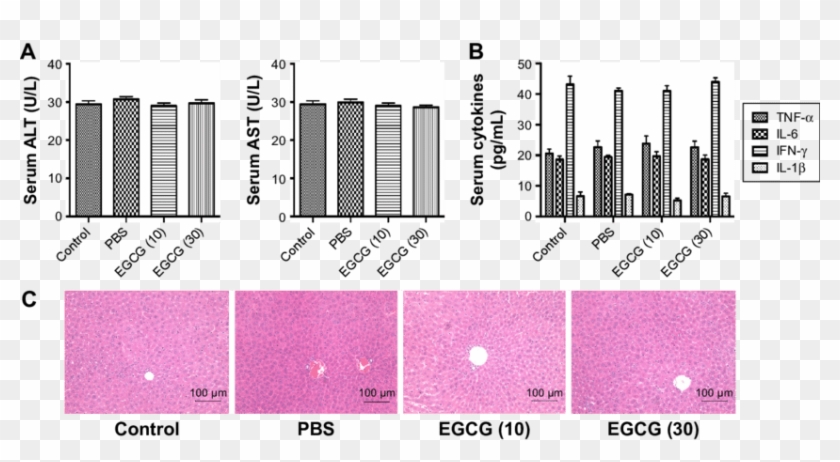 Effects Of Pbs And Egcg On The Liver Function And Pathology - Lilac Clipart #2538611