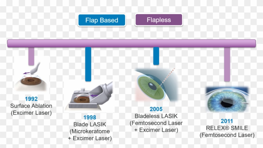 Evolution Of Lasik - Microkeratome Blade Clipart #2551619