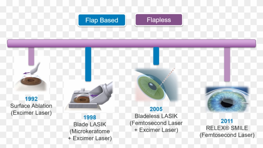 Evolution Of Lasik - Microkeratome Blade Clipart