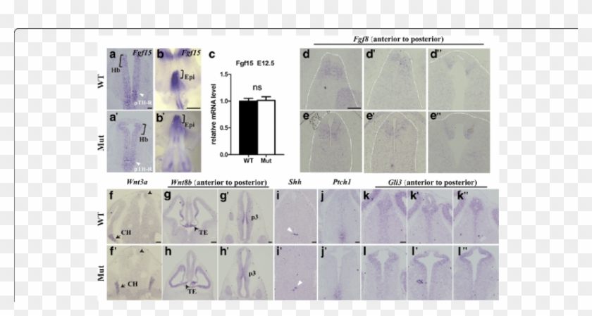 Shh And Fgf Signalling Were Not Affected In The Epithalamic - Composite Material Clipart