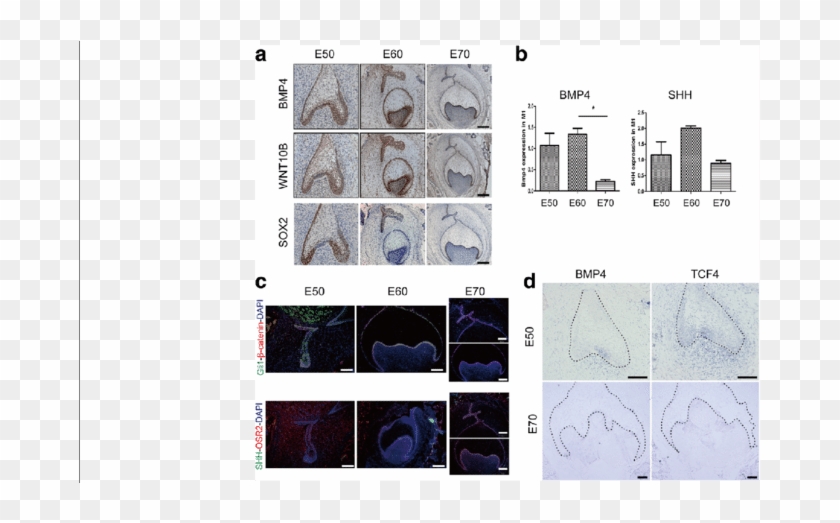 Gene Expression In Shh, Wnt And Tgf-β Pathways During - Pattern Clipart