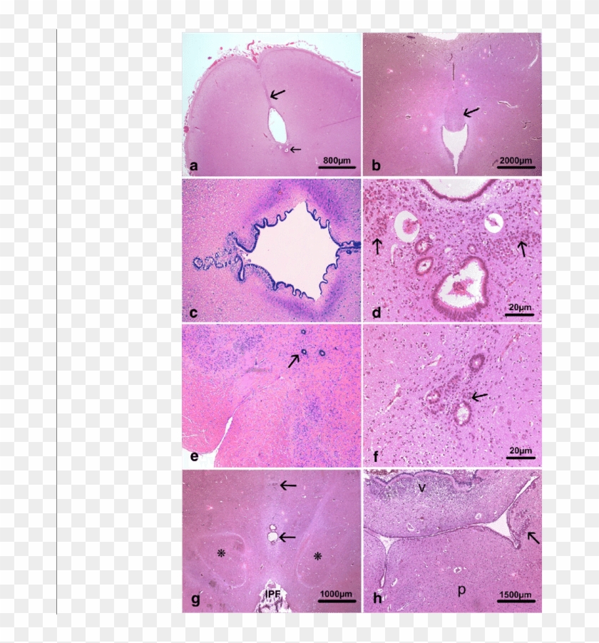 Main Histological Lesions Consisted In Hypoplasia Of - Illustration Clipart #2647937