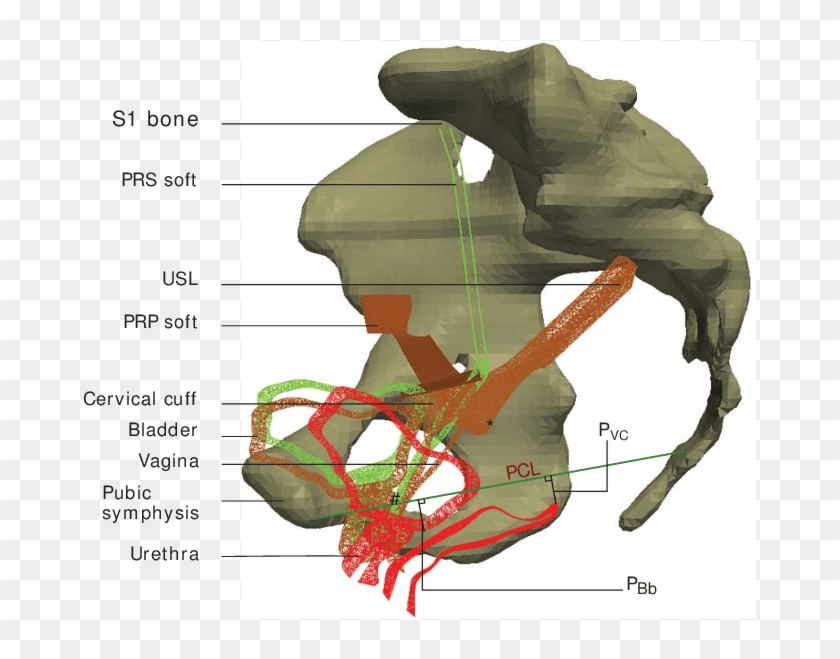 Sagittal Slices Measuring The Bladder Base And The - Profile Vaginal Vault Clipart #2659772