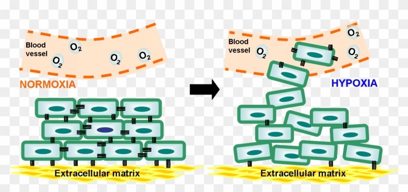 These May Prevent The Detachment Of Cancer Cells From Clipart
