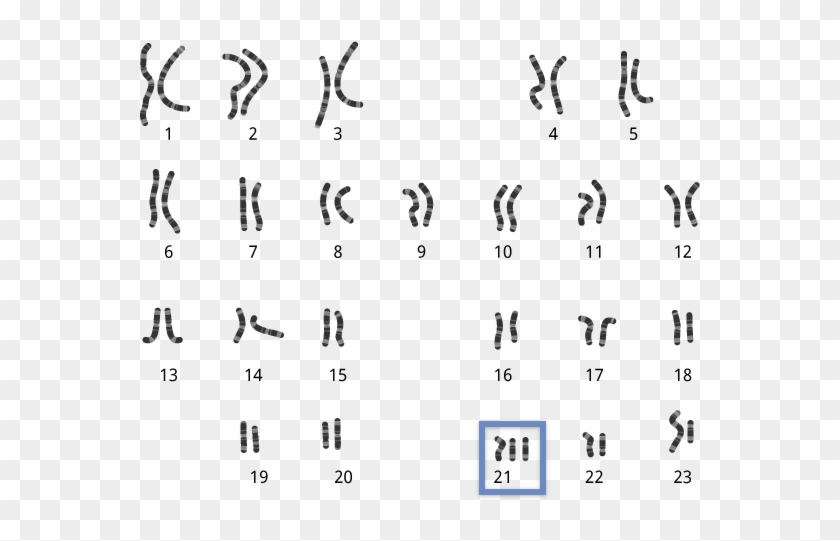 Chromosomes-abnormal - Abnormal Chromosomes Clipart