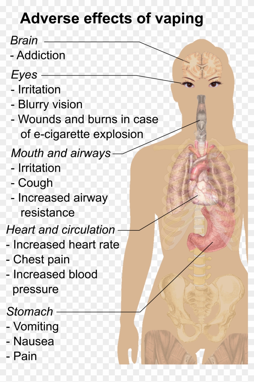 Adverse Effects Of Vaping - Effects Of Vaping Clipart #2719423