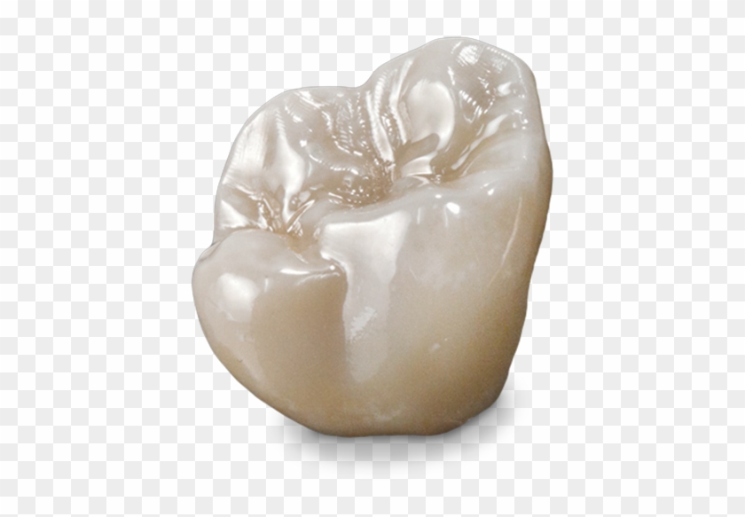 Zeus™ Full Contour Zirconia - Chair Clipart