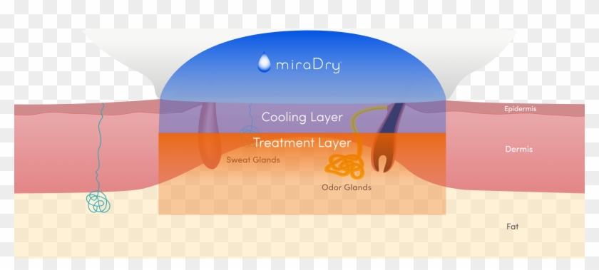 Finally, Thermal Energy Is Delivered And The Sweat - Graphic Design Clipart