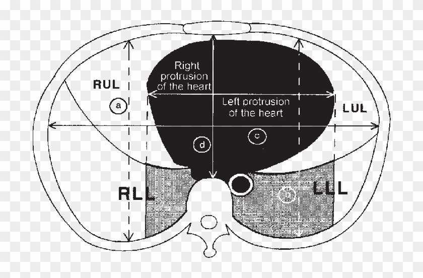 Schematic Representation Of A Ct Section Obtained In - Circle Clipart