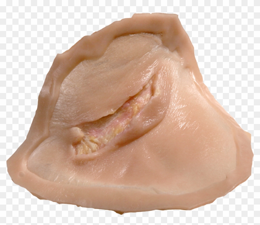 Drawing Scars Bruise - Chicken Breast Clipart #2819071