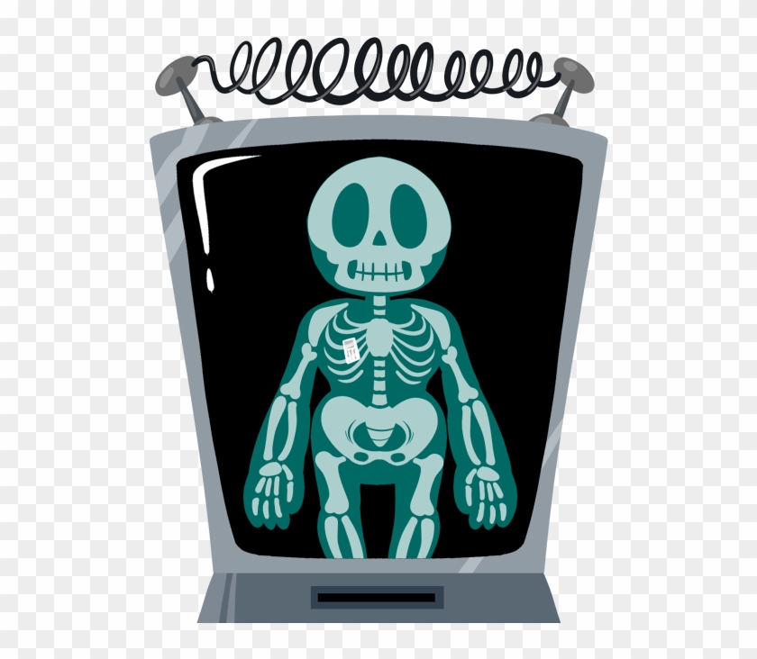 X Ray Png - Xray Png Clipart