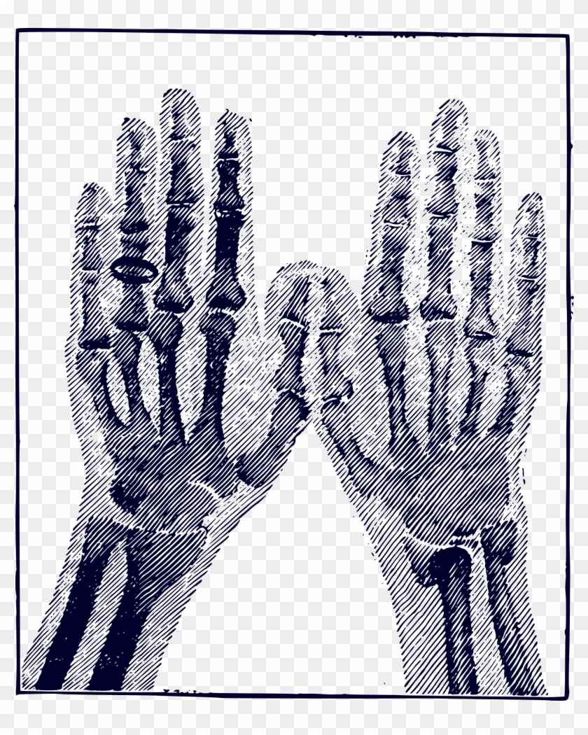 This Free Icons Png Design Of X-ray Image - X Ray Hand Png Vector Free Illustrator Clipart #2864896