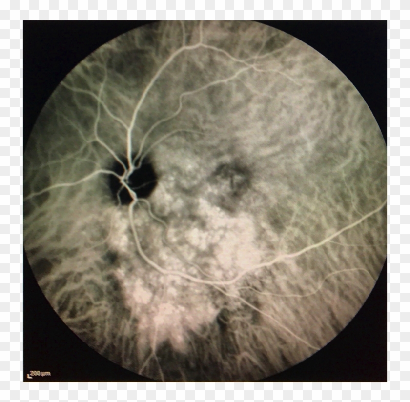 Î”îÿîšî¥î'î Î™î Î Clipart #2877781